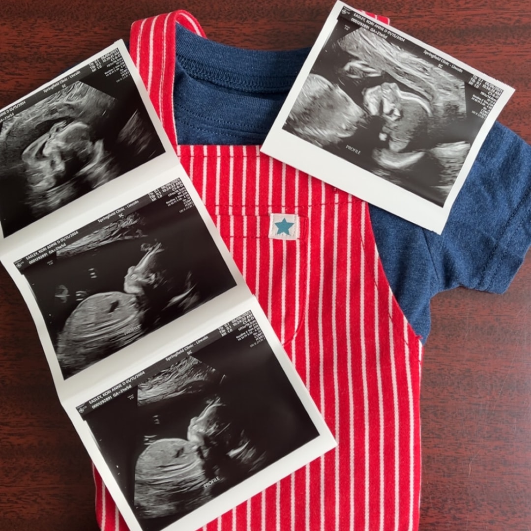 Photo shared by KoriAnne for their Babylist baby registry.