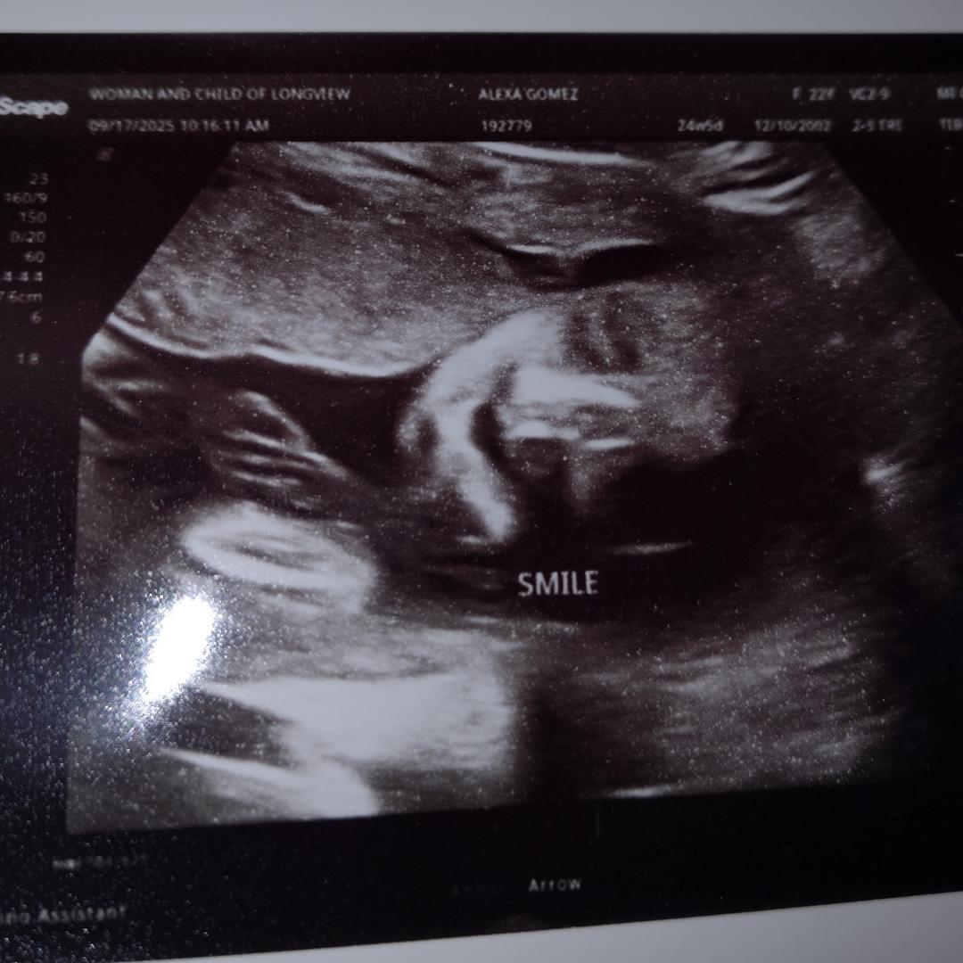 Photo shared by Alexa for their Babylist baby registry.