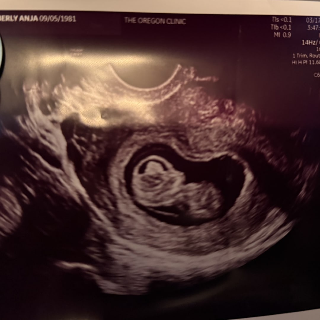 Photo shared by Kimberly for their Babylist baby registry.