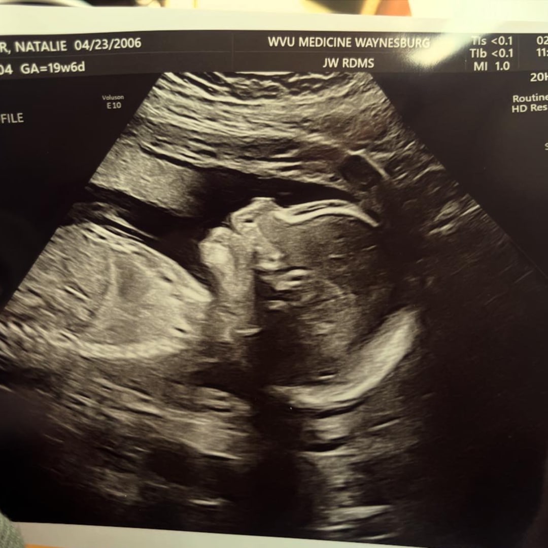 Photo shared by Natalie for their Babylist baby registry.
