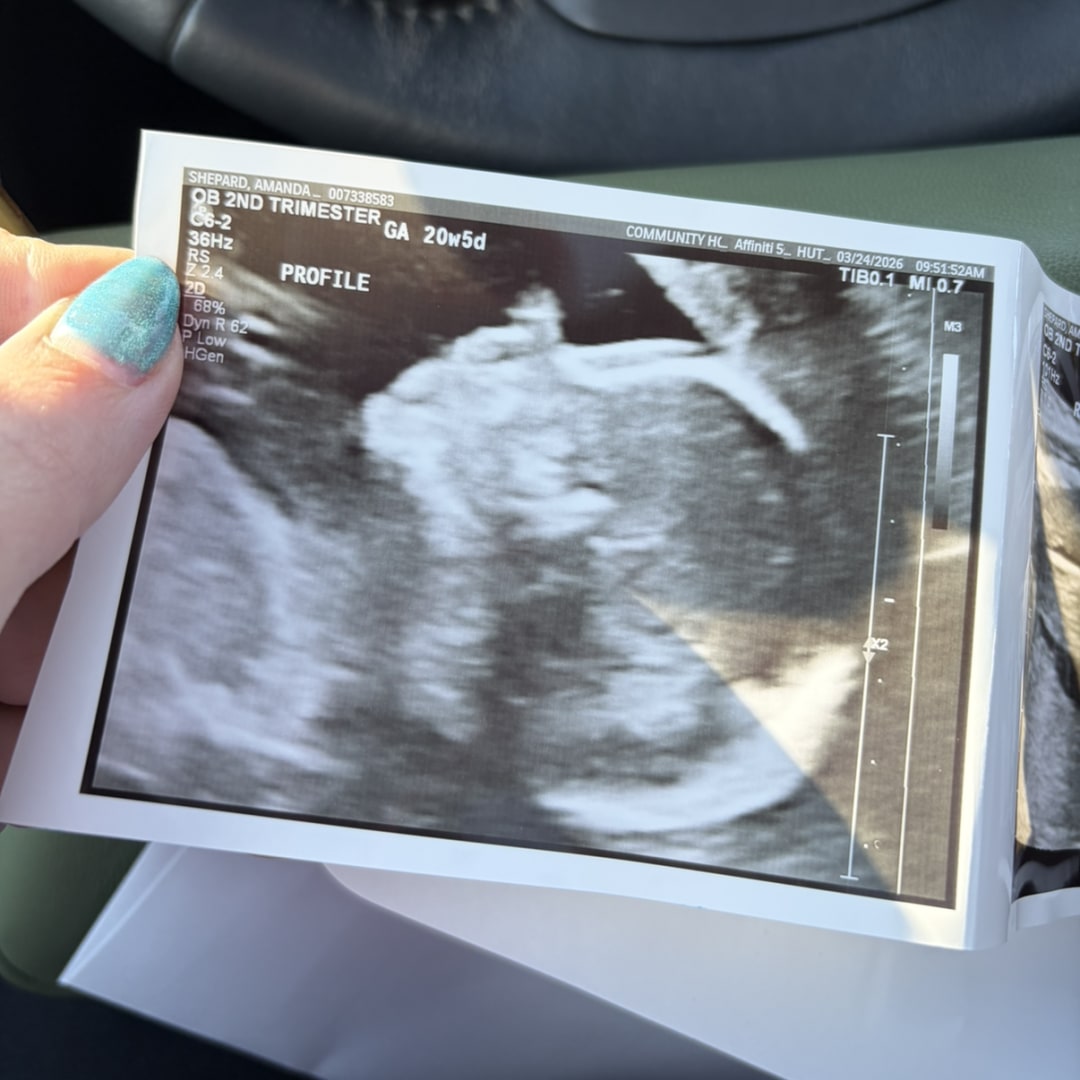 Photo shared by Amanda for their Babylist baby registry.