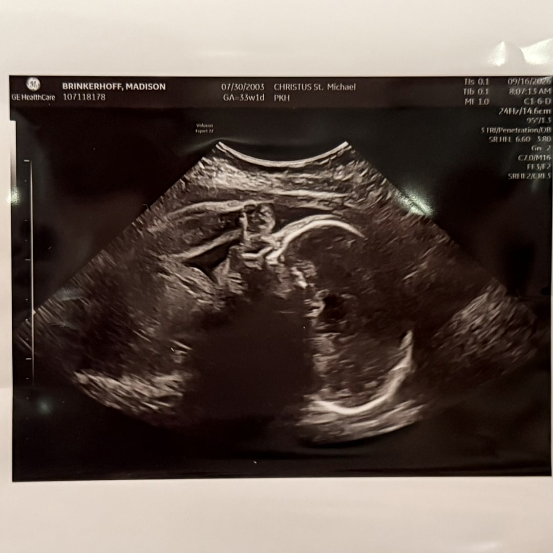 Photo shared by Madison for their Babylist baby registry.