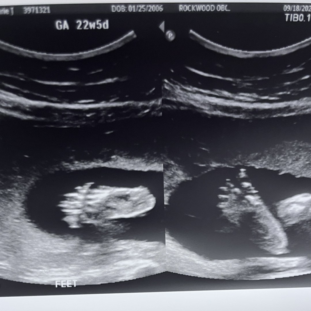 Photo shared by Annmarie for their Babylist baby registry.