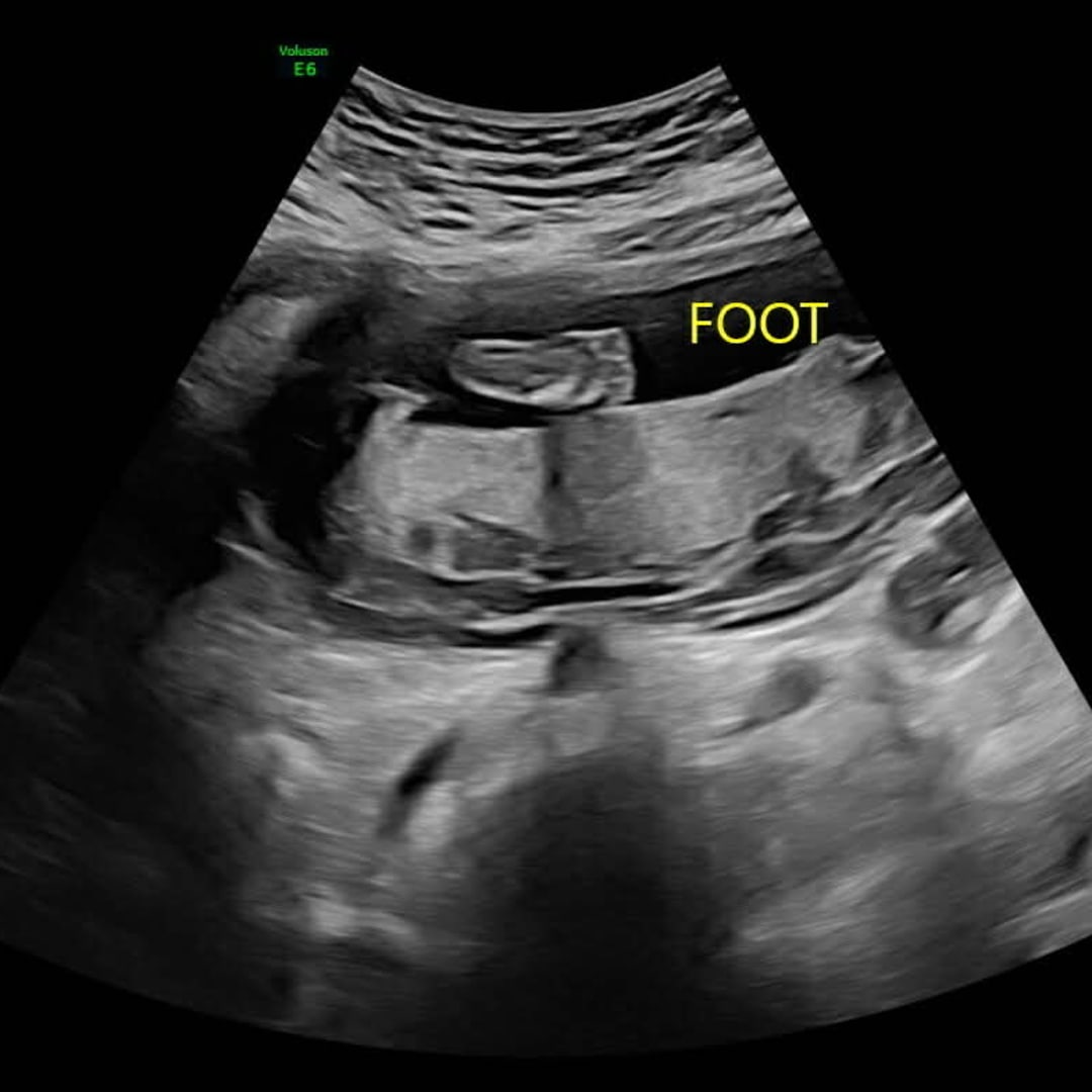 Photo shared by Kadence for their Babylist baby registry.