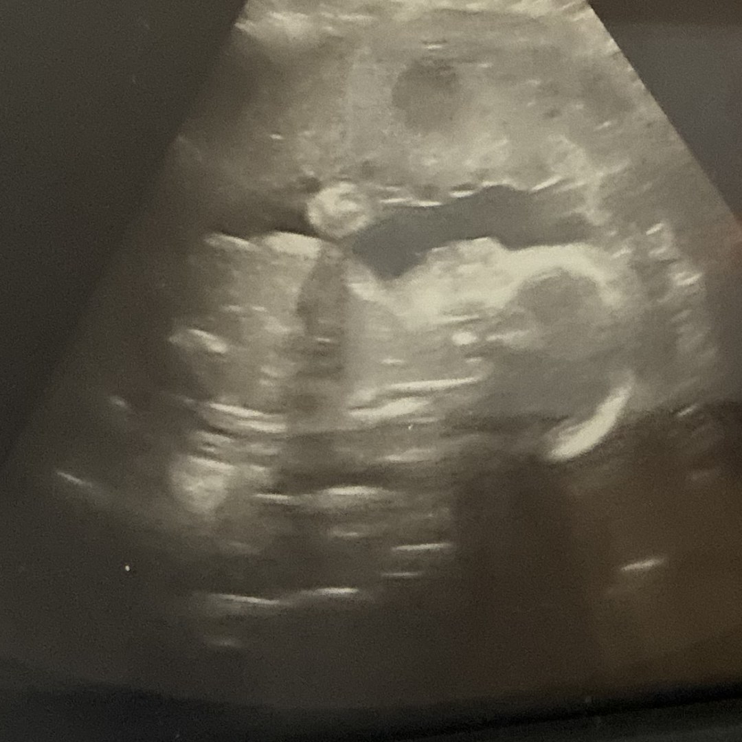 Photo shared by LaChelle for their Babylist baby registry.