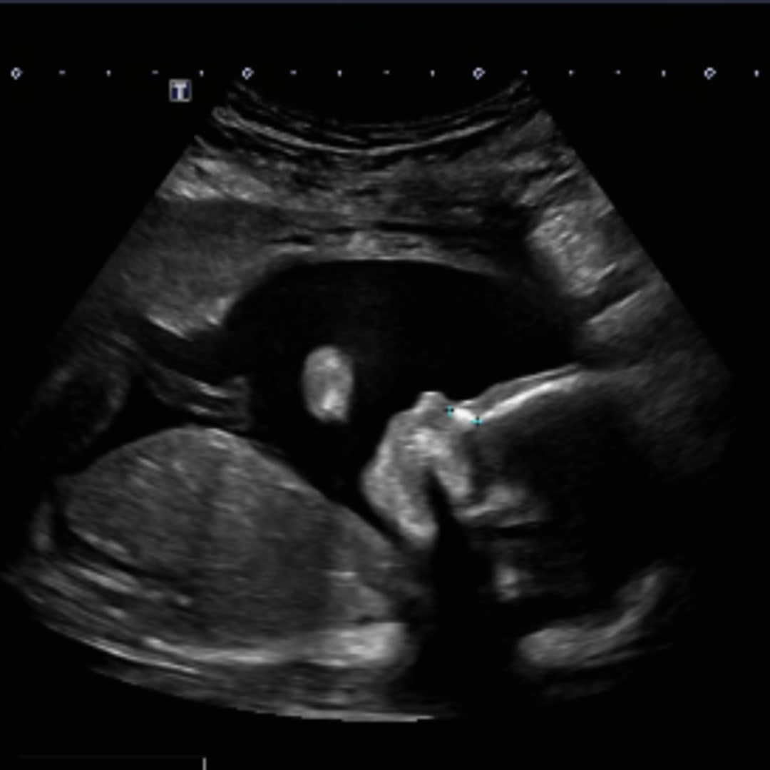 Photo shared by Graci for their Babylist baby registry.