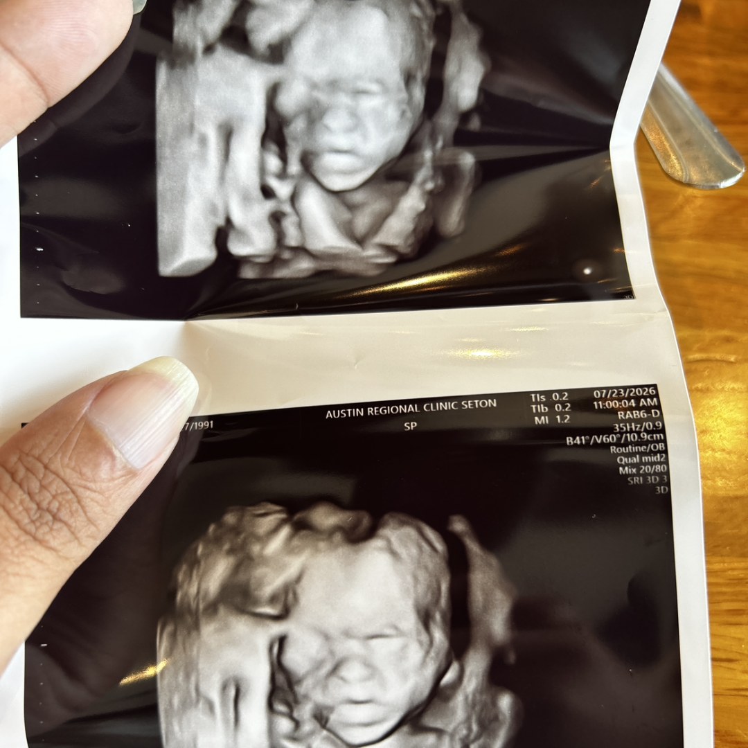 Photo shared by Evann for their Babylist baby registry.