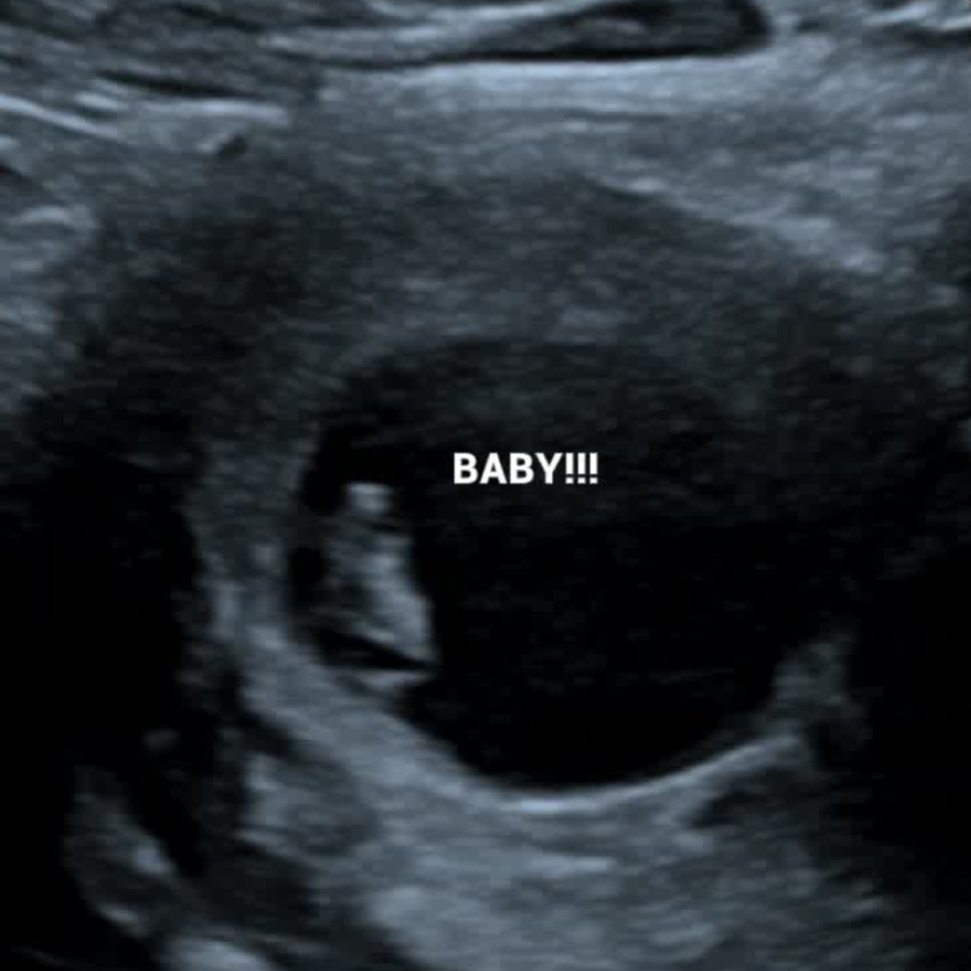 Photo shared by Addison for their Babylist baby registry.