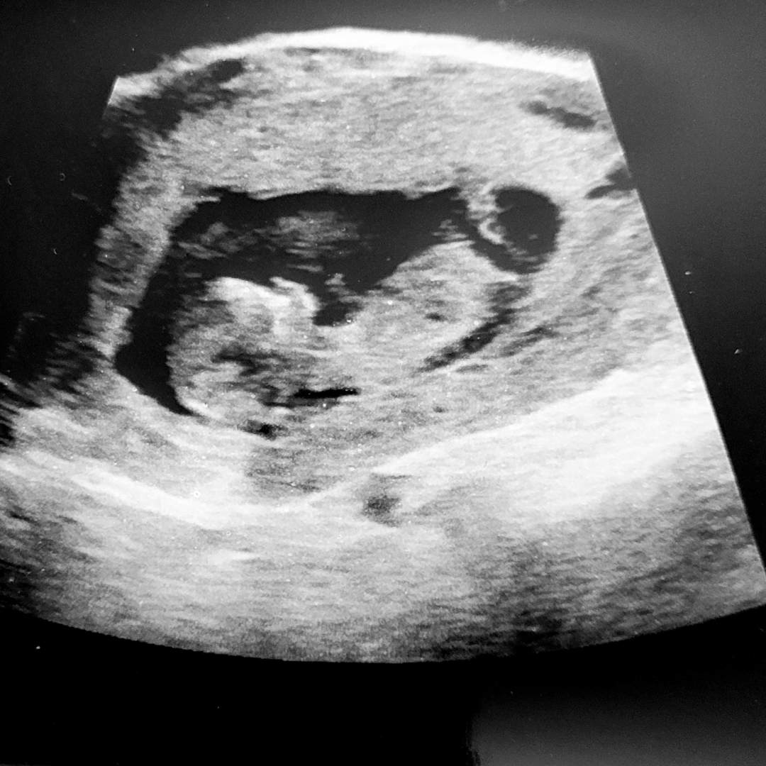 Photo shared by Erin for their Babylist baby registry.