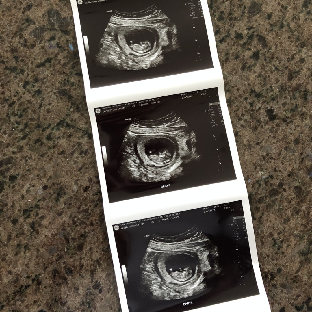 Photo shared by Blakeley for their Babylist baby registry.