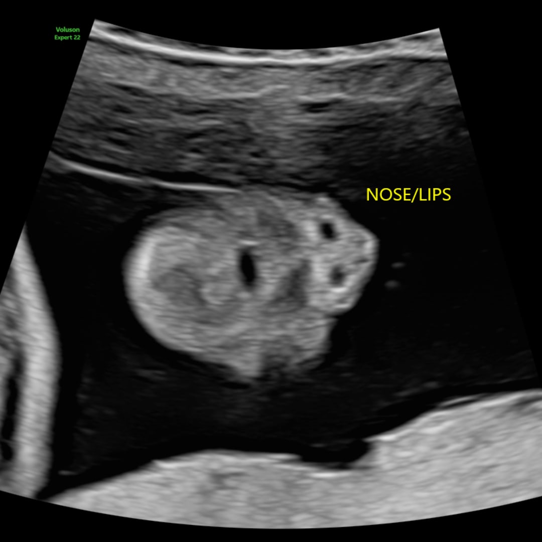 Photo shared by Daisy for their Babylist baby registry.