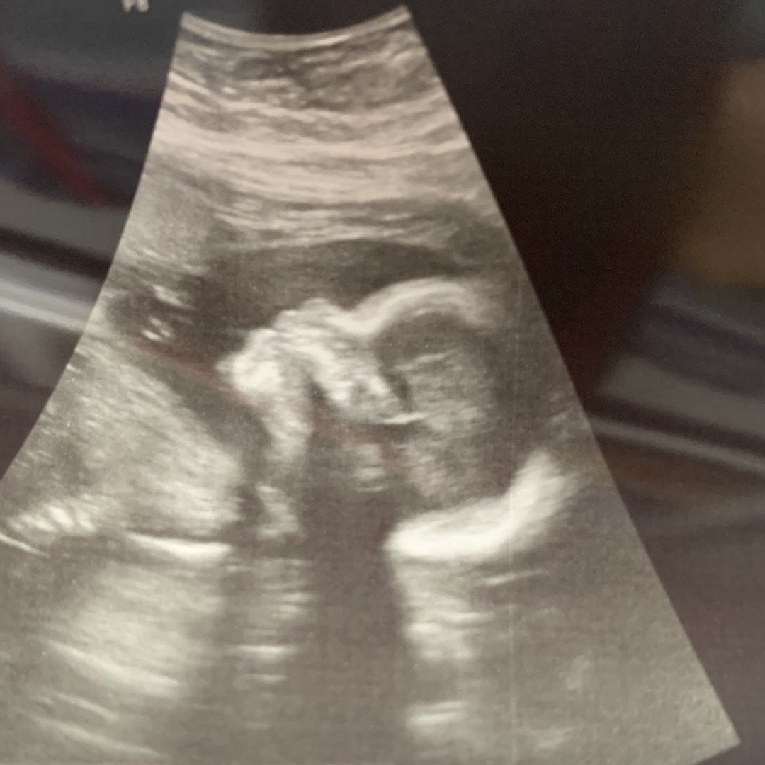 Photo shared by Natasha for their Babylist baby registry.