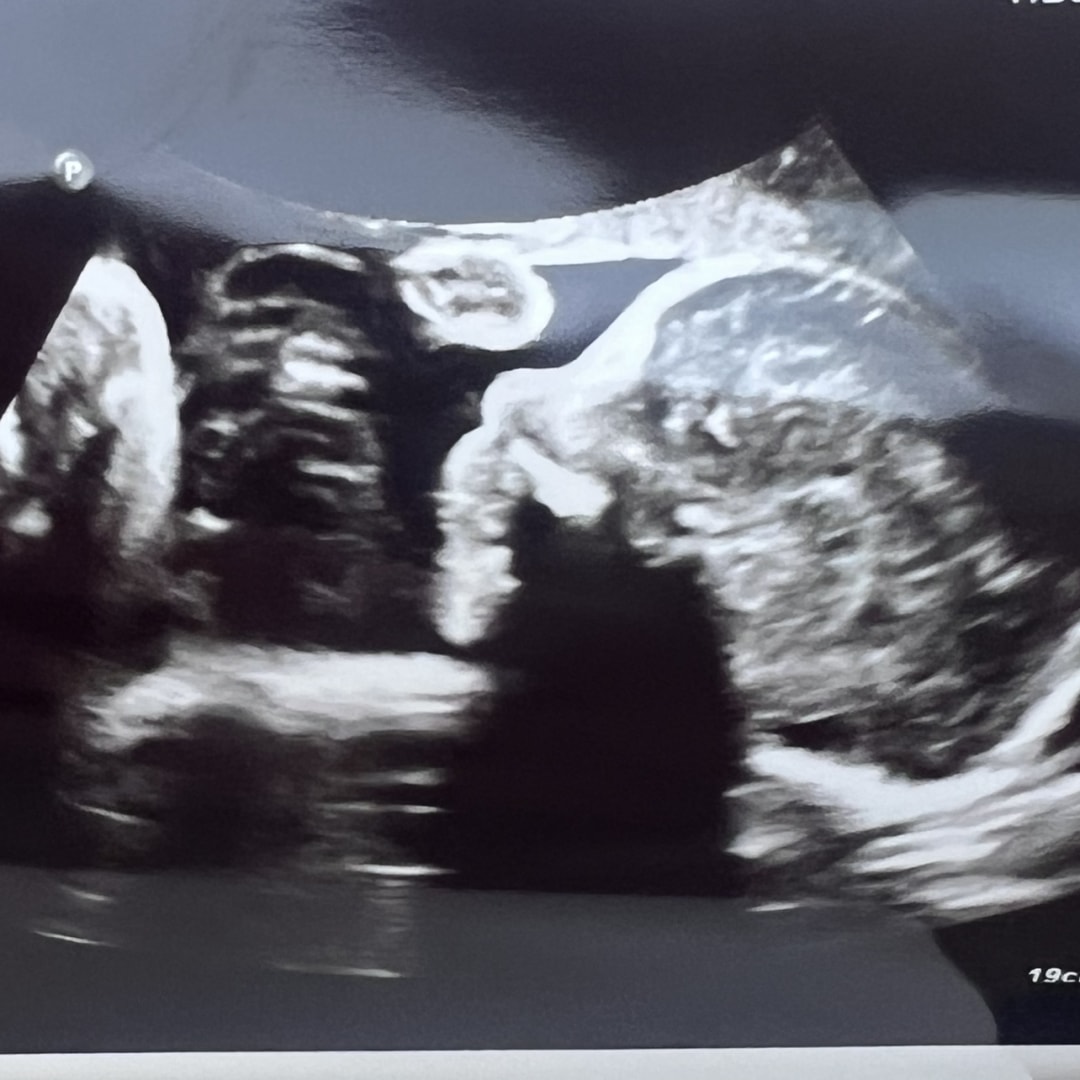 Photo shared by Brittani for their Babylist baby registry.
