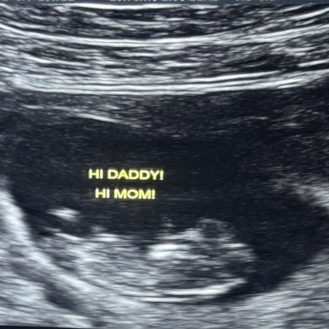 Photo shared by Jesse for their Babylist baby registry.