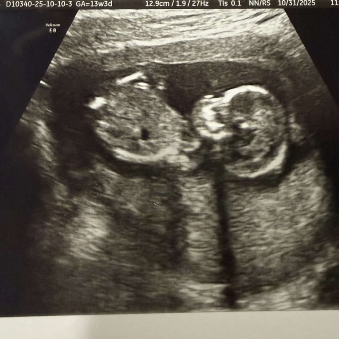 Photo shared by Kristin for their Babylist baby registry.