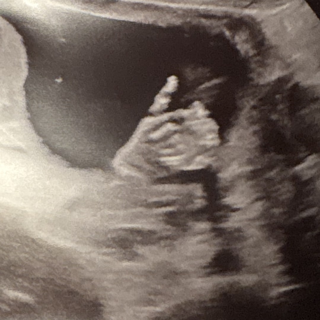 Photo shared by Jasmyn for their Babylist baby registry.