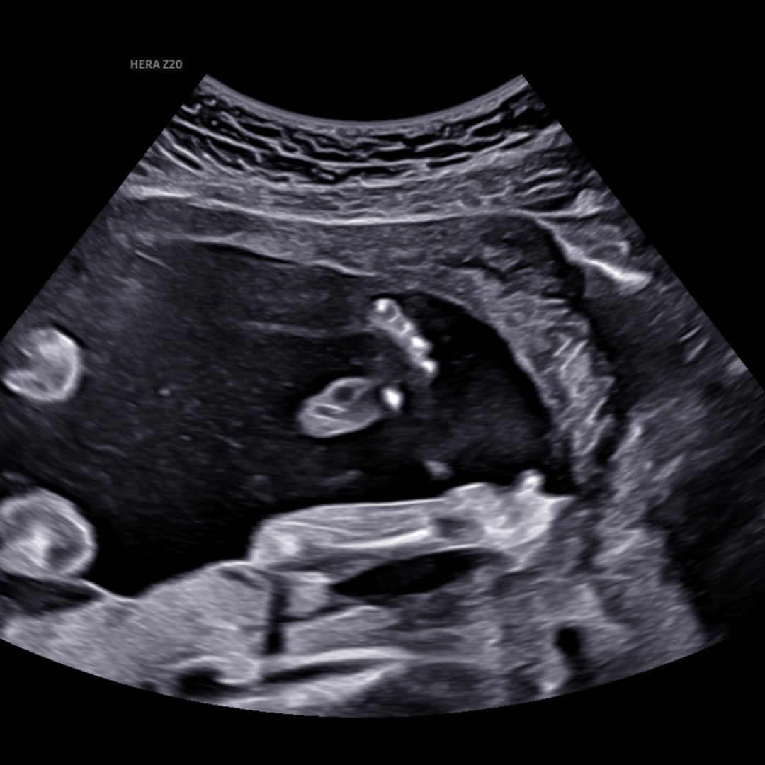 Photo shared by Adeleni for their Babylist baby registry.