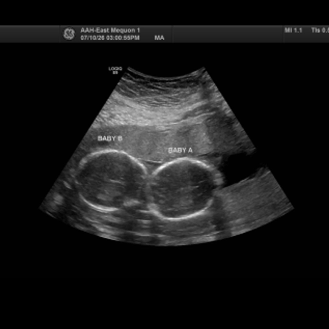 Photo shared by Breanna for their Babylist baby registry.
