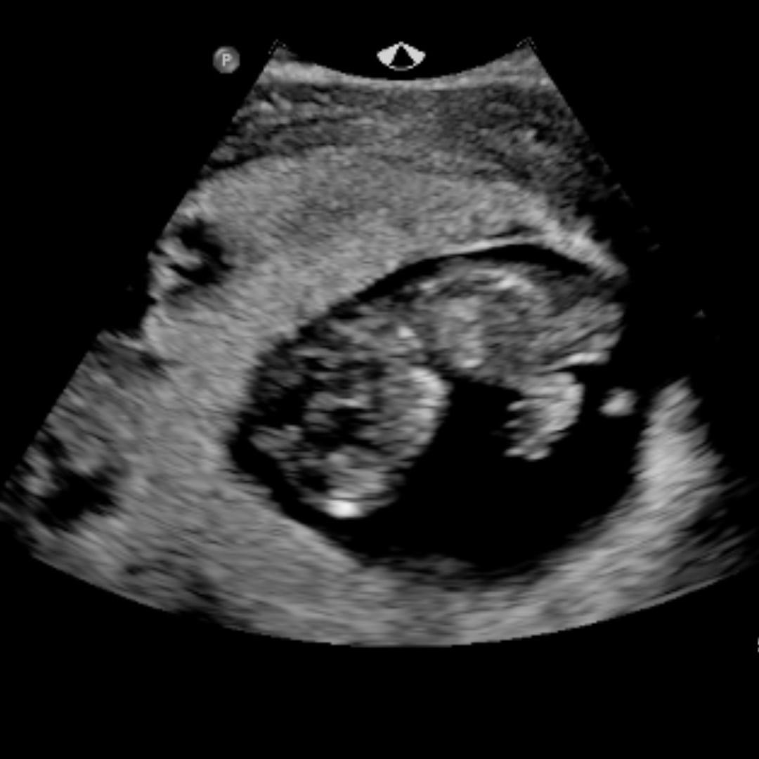 Photo shared by Ashley for their Babylist baby registry.