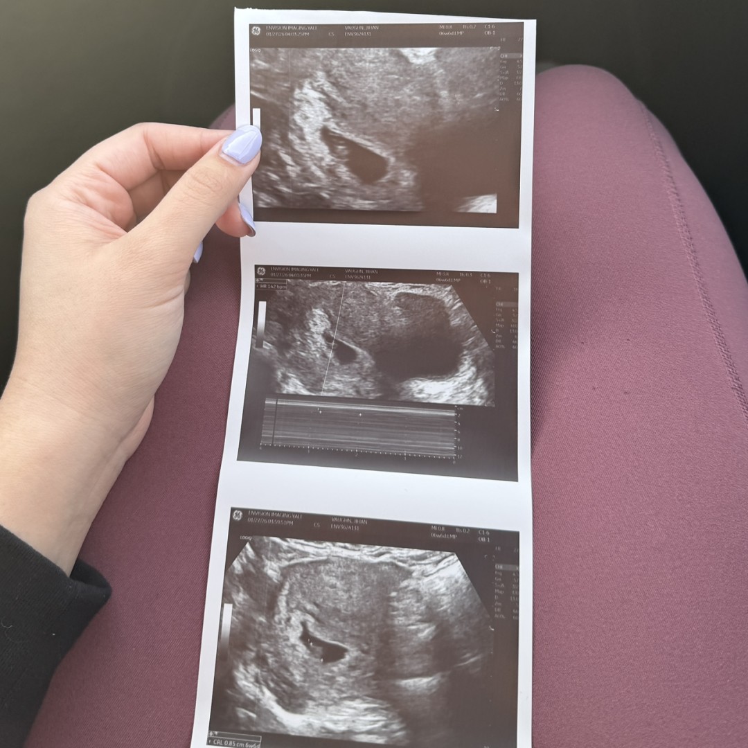 Photo shared by Juju for their Babylist baby registry.