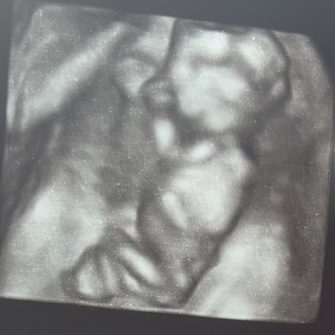 Photo shared by Bethany for their Babylist baby registry.