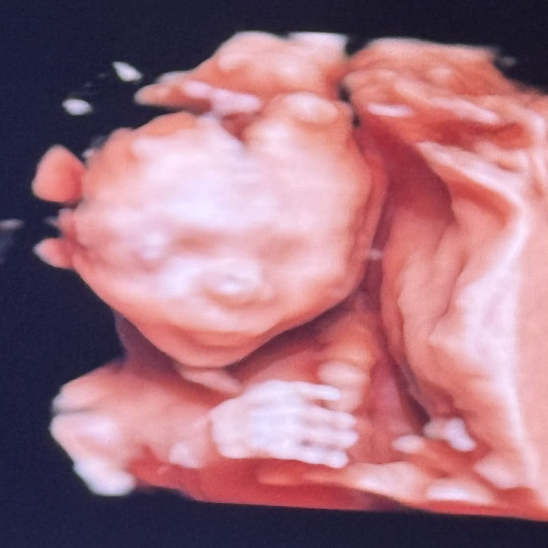 Photo shared by Desiree for their Babylist baby registry.