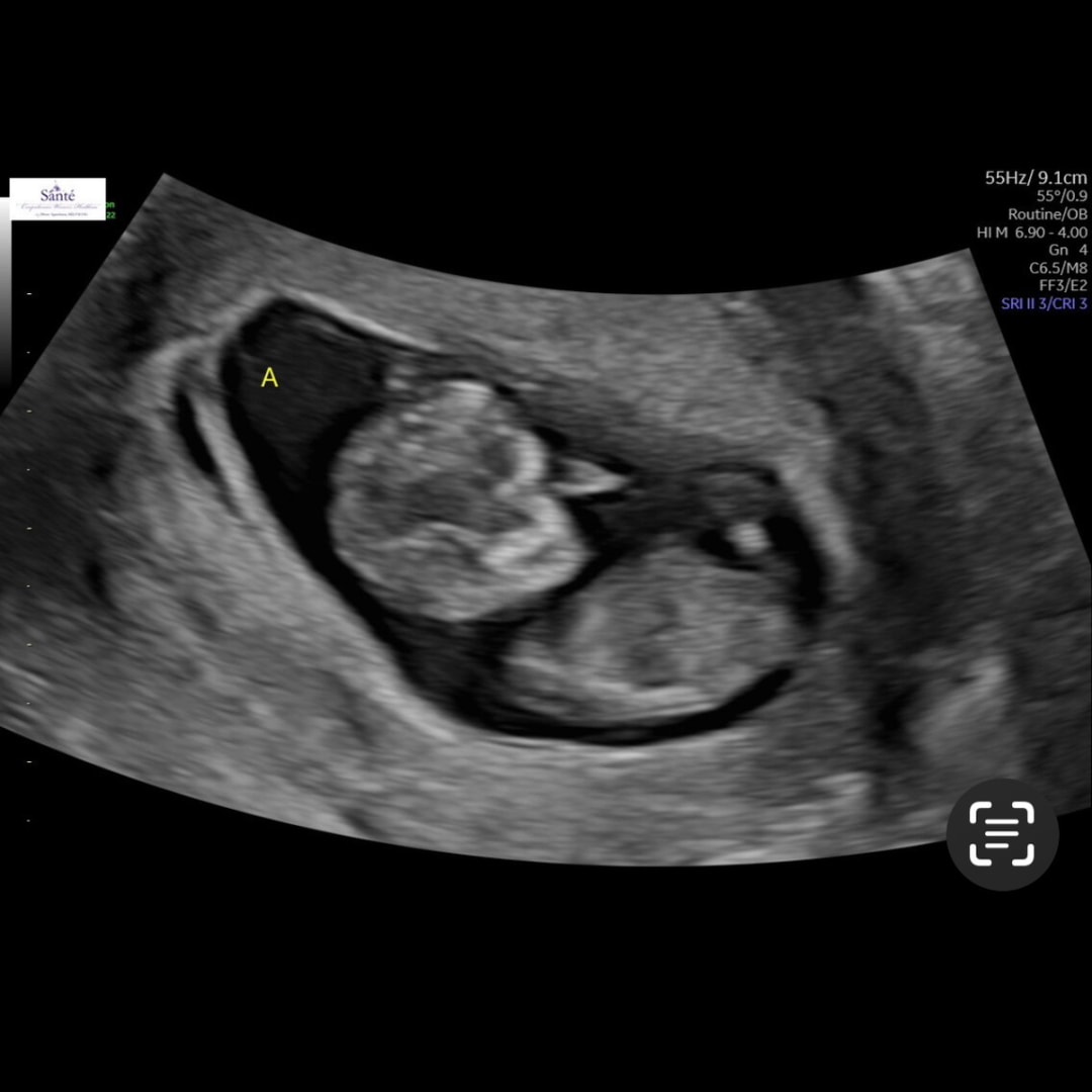 Photo shared by Jacklyn for their Babylist baby registry.