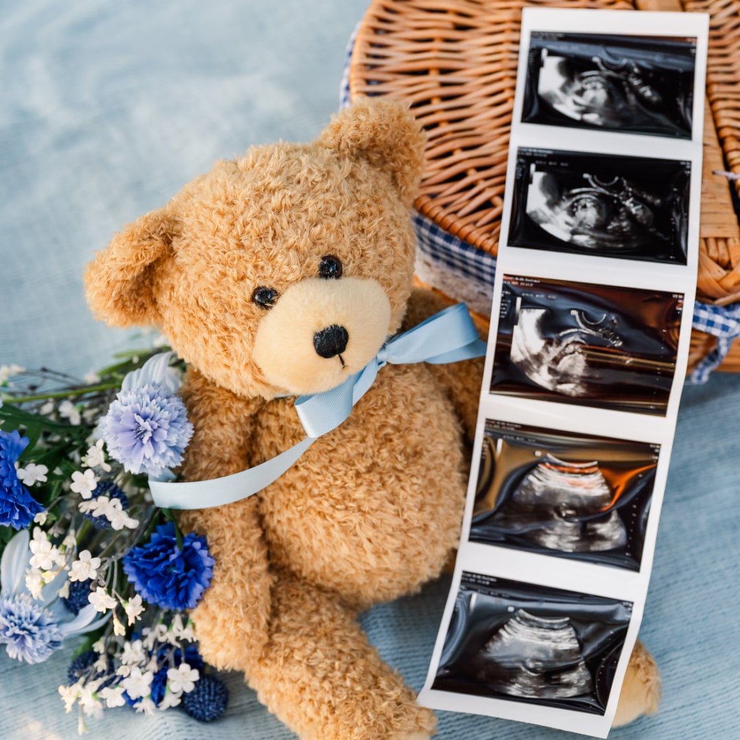 Photo shared by Kassidy for their Babylist baby registry.