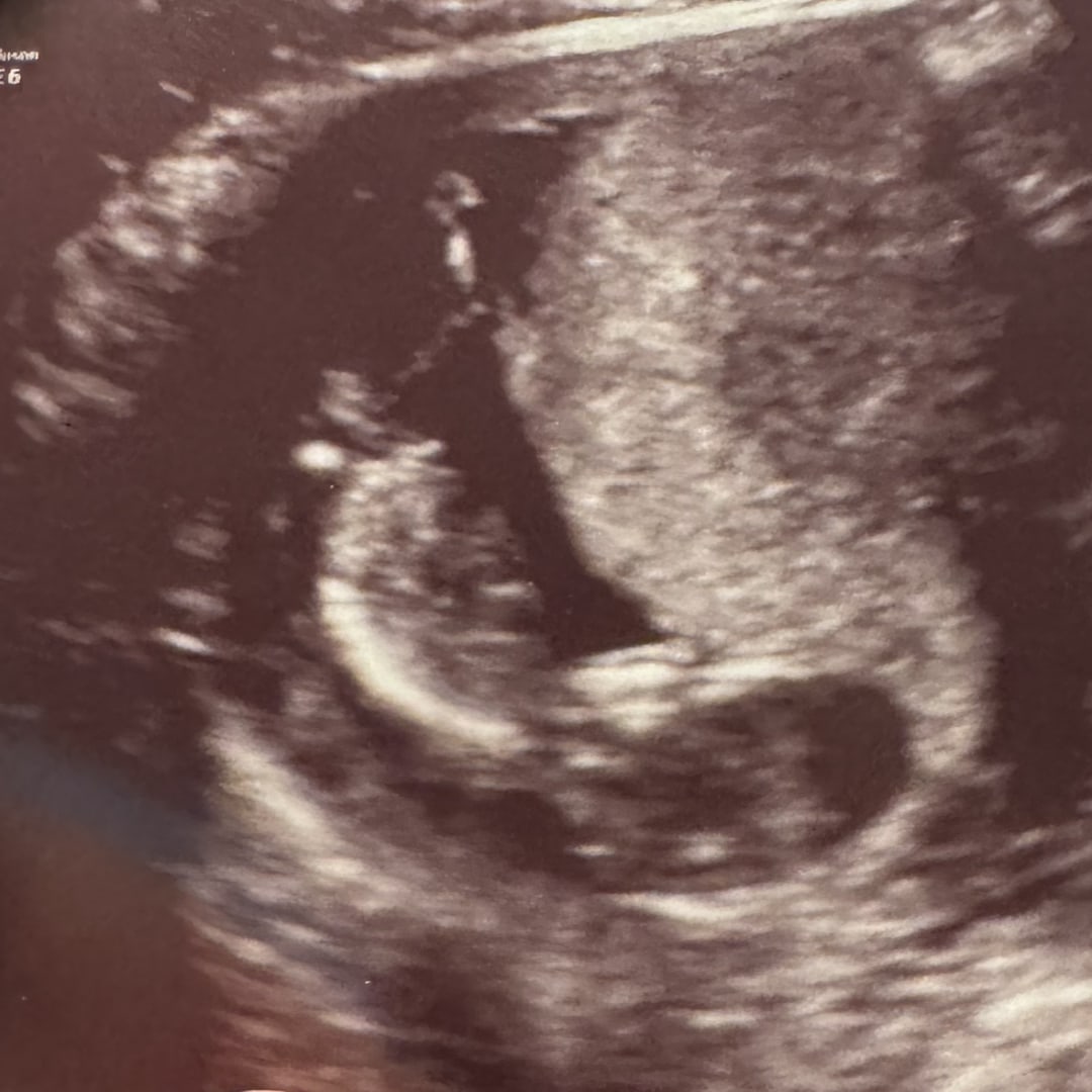 Photo shared by Brandi for their Babylist baby registry.