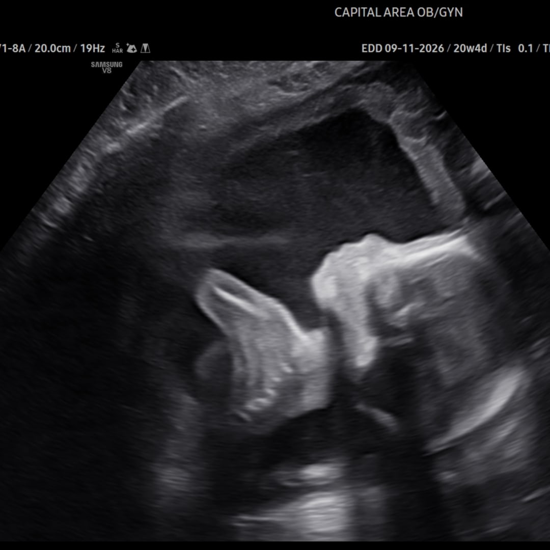 Photo shared by Emily for their Babylist baby registry.