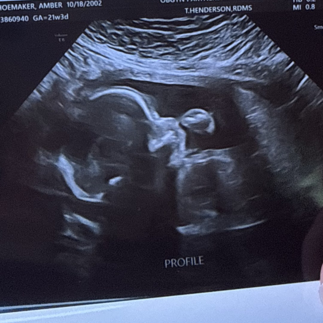 Photo shared by Amber for their Babylist baby registry.