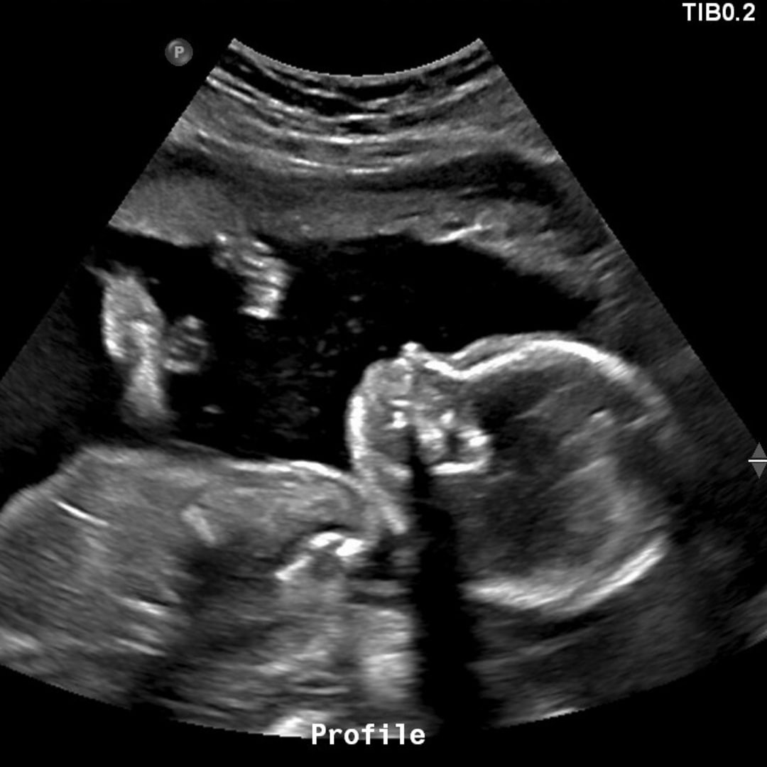 Photo shared by Shalynn & William for their Babylist baby registry.