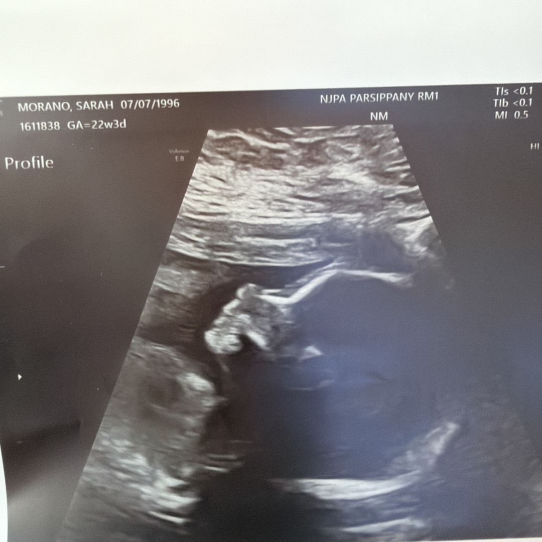 Photo shared by Sarah for their Babylist baby registry.