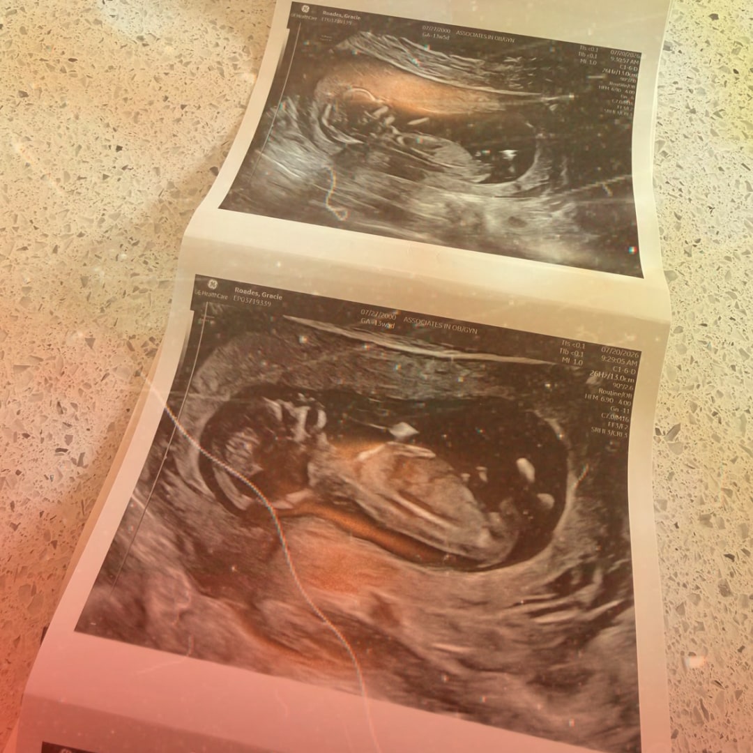 Photo shared by Gracie for their Babylist baby registry.