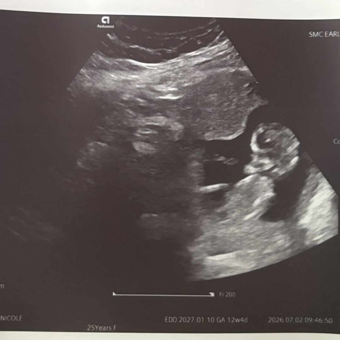 Photo shared by Alexis for their Babylist baby registry.