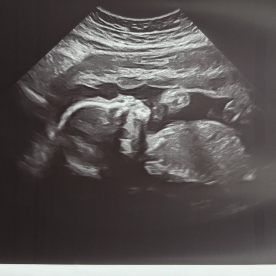 Photo shared by Alexis for their Babylist baby registry.