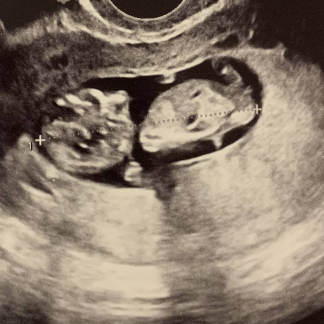 Photo shared by Ashley for their Babylist baby registry.