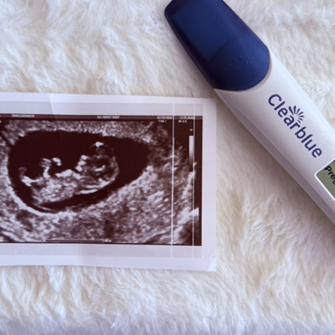 Photo shared by Alexandra for their Babylist baby registry.