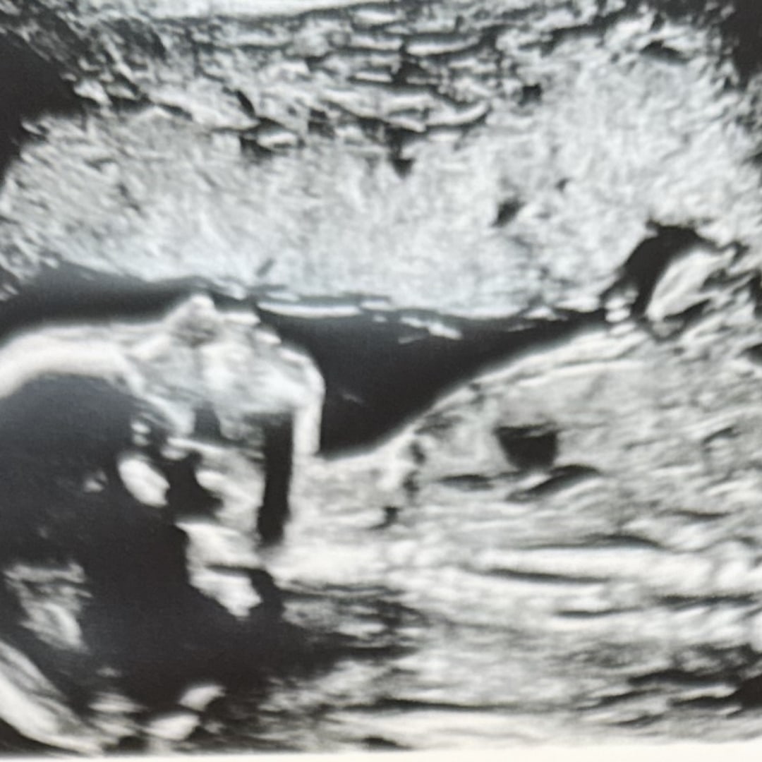 Photo shared by Kasey for their Babylist baby registry.