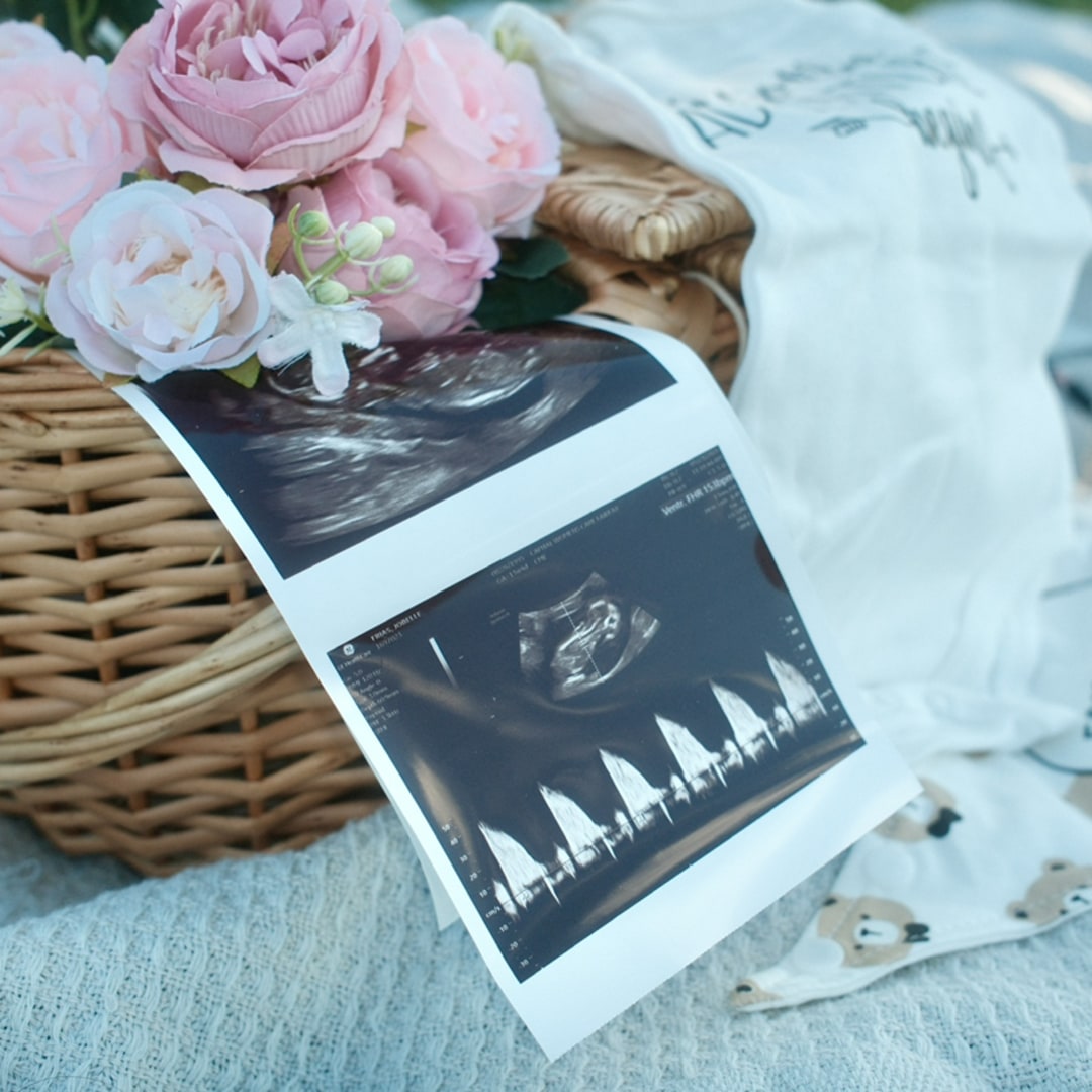 Photo shared by Belle for their Babylist baby registry.