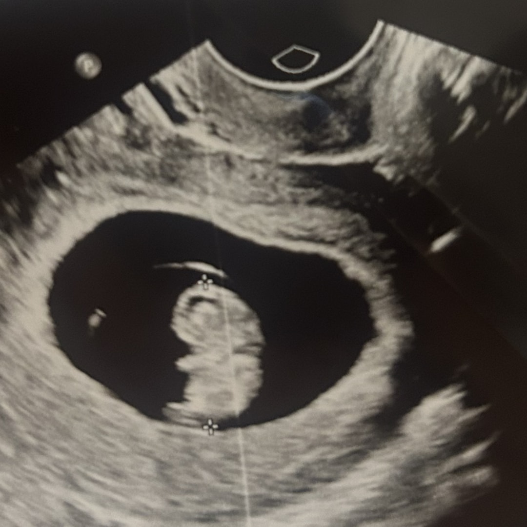Photo shared by Regina for their Babylist baby registry.
