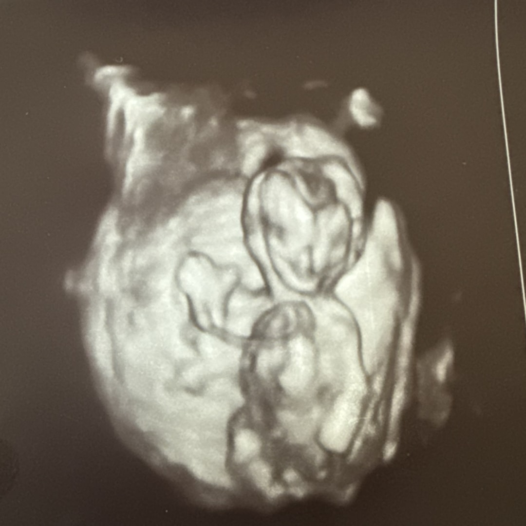 Photo shared by Debbie for their Babylist baby registry.