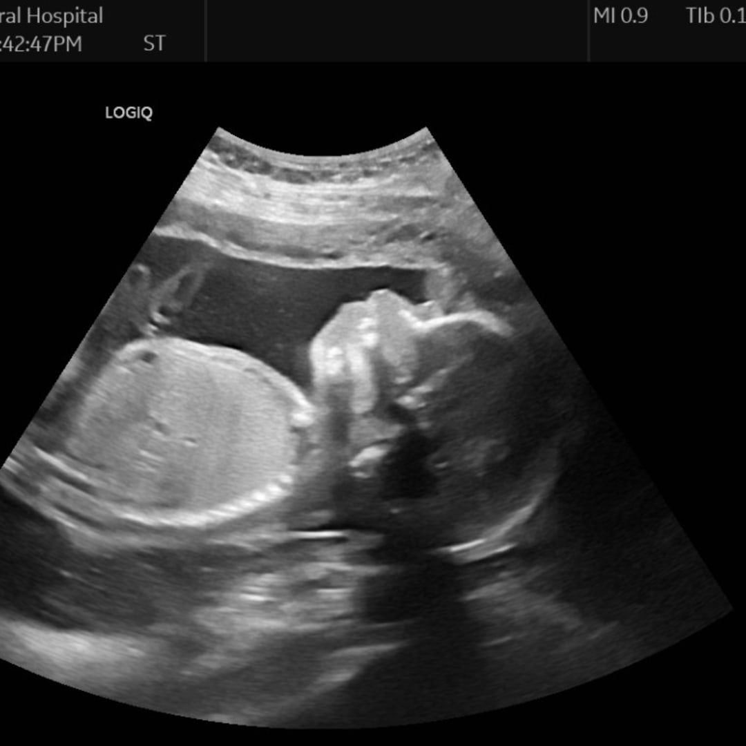 Photo shared by Marianne for their Babylist baby registry.