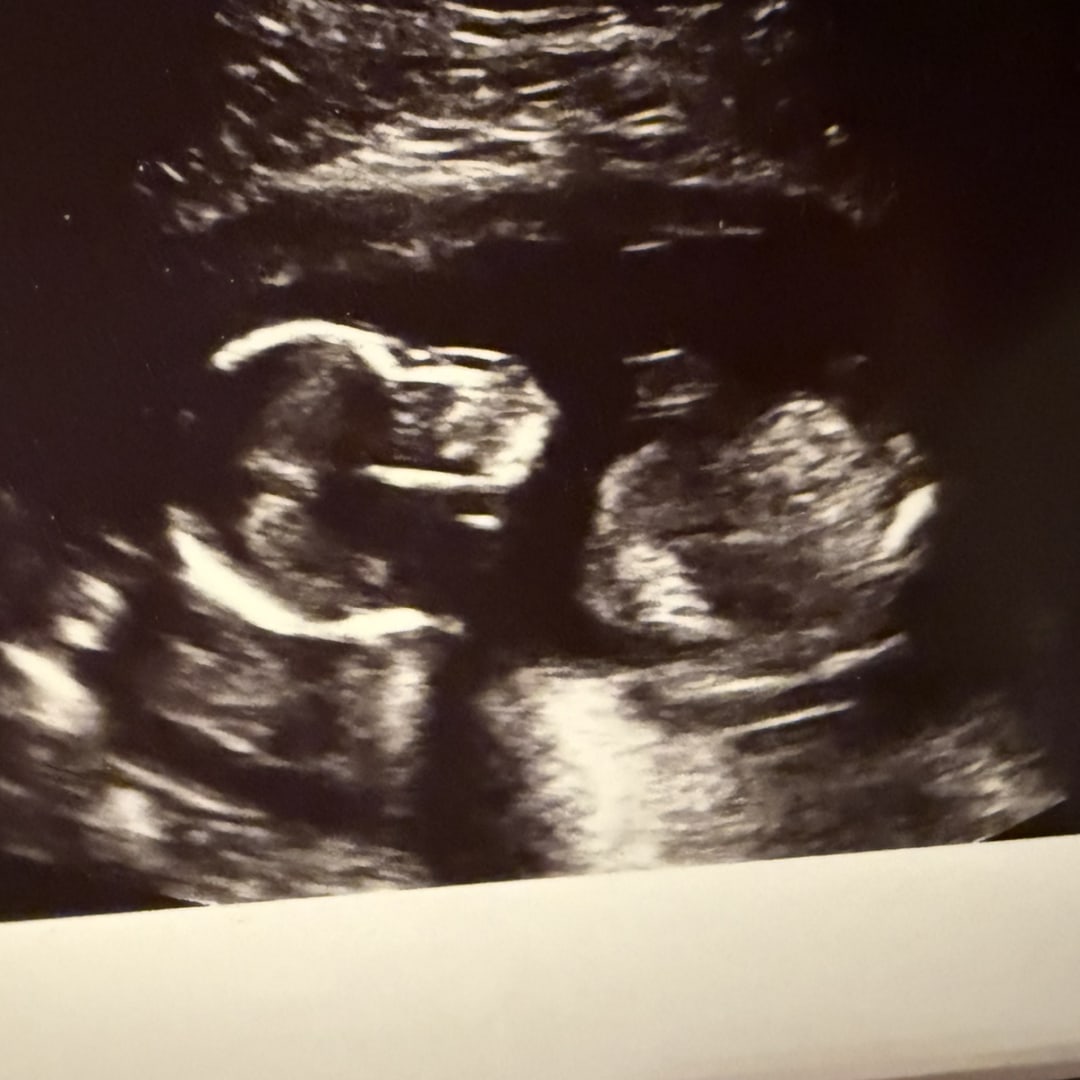 Photo shared by Alicia for their Babylist baby registry.