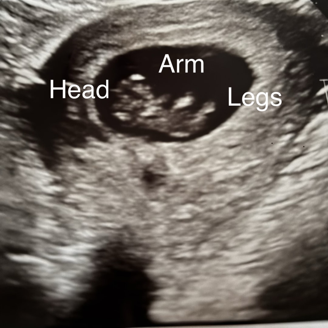 Photo shared by April for their Babylist baby registry.