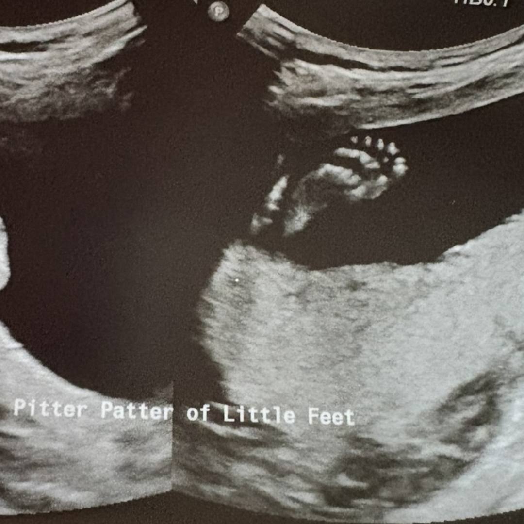 Photo shared by Ann-Sophie for their Babylist baby registry.