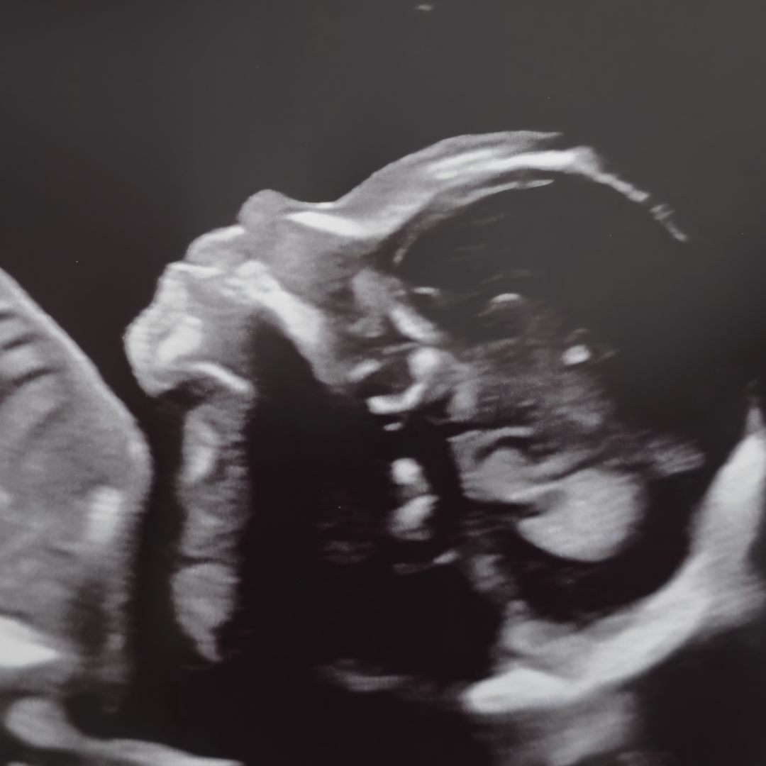 Photo shared by Hallie for their Babylist baby registry.