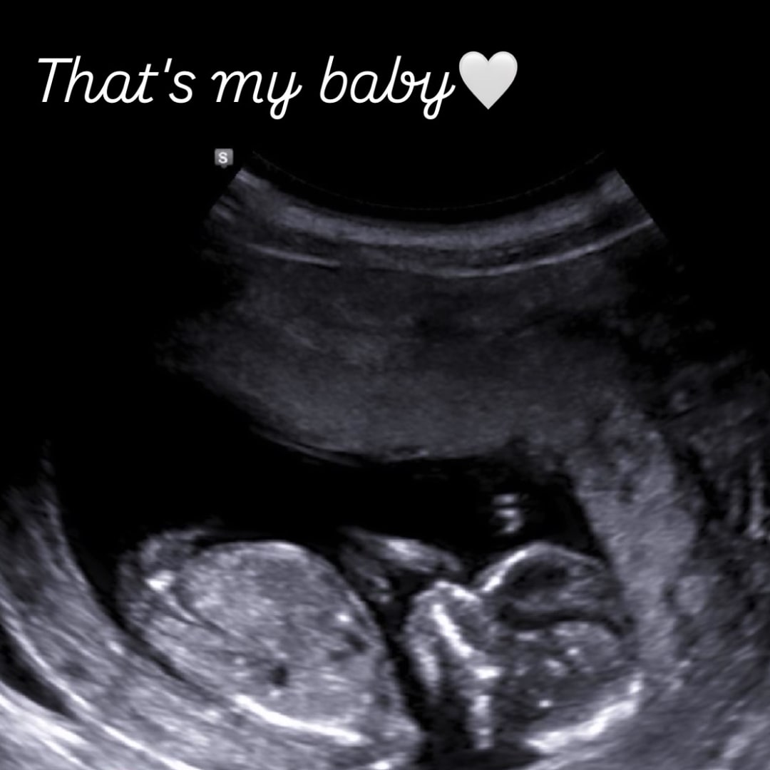 Photo shared by Mia for their Babylist baby registry.