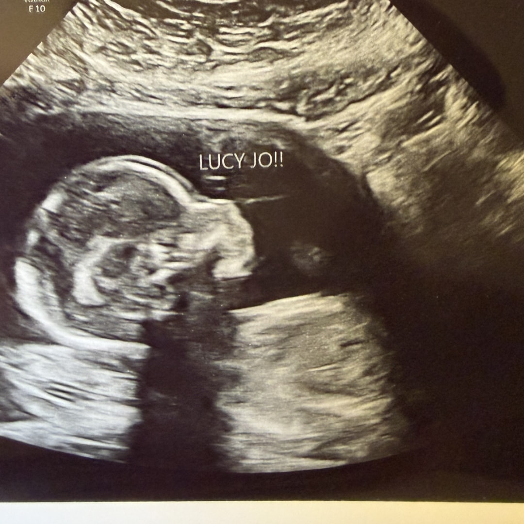 Photo shared by Madison for their Babylist baby registry.