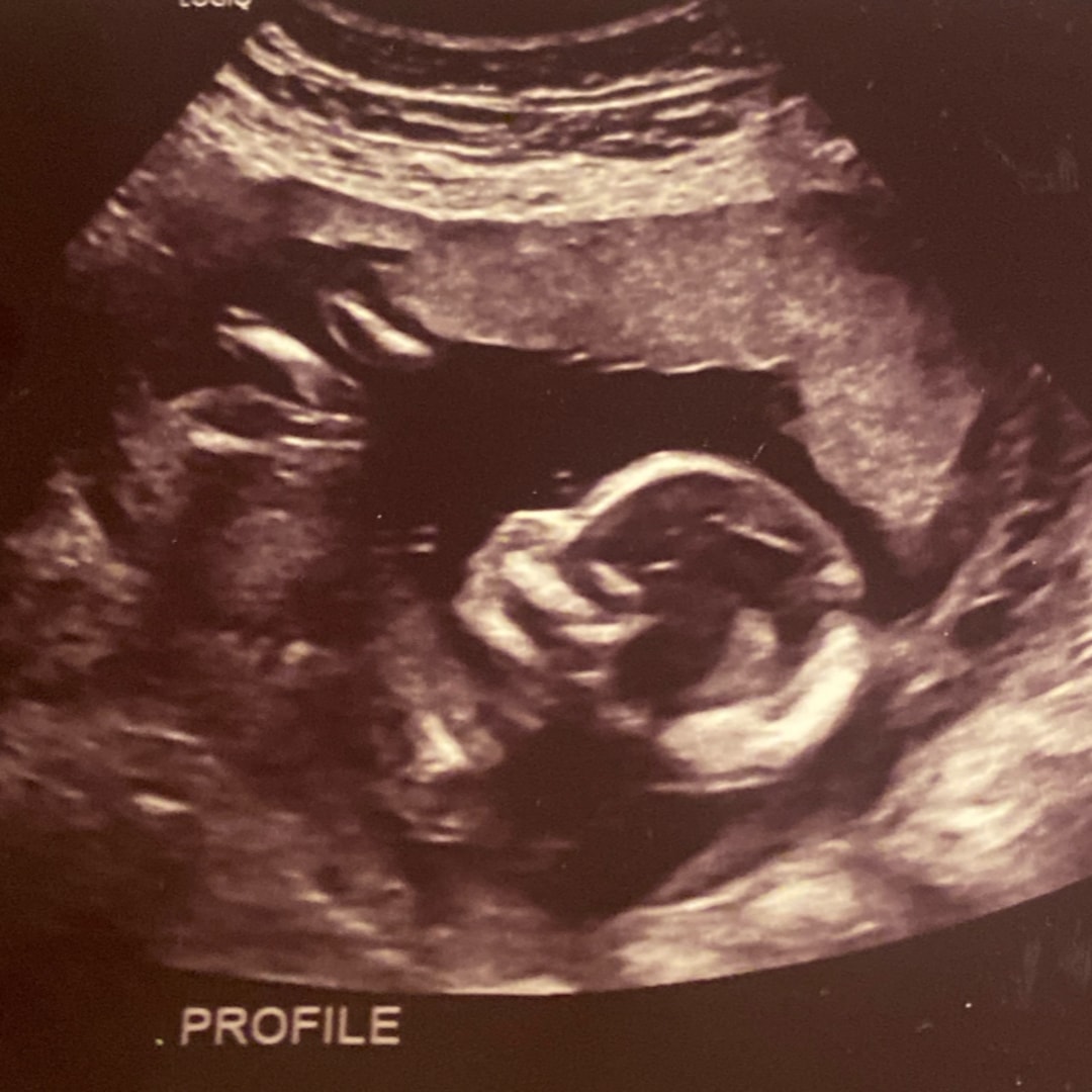 Photo shared by Sarah for their Babylist baby registry.